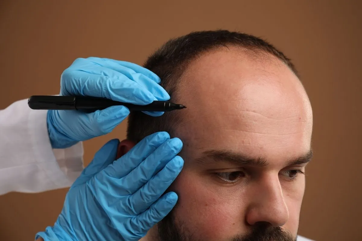 Tratamiento de estética capilar en Glow Medical Clinique