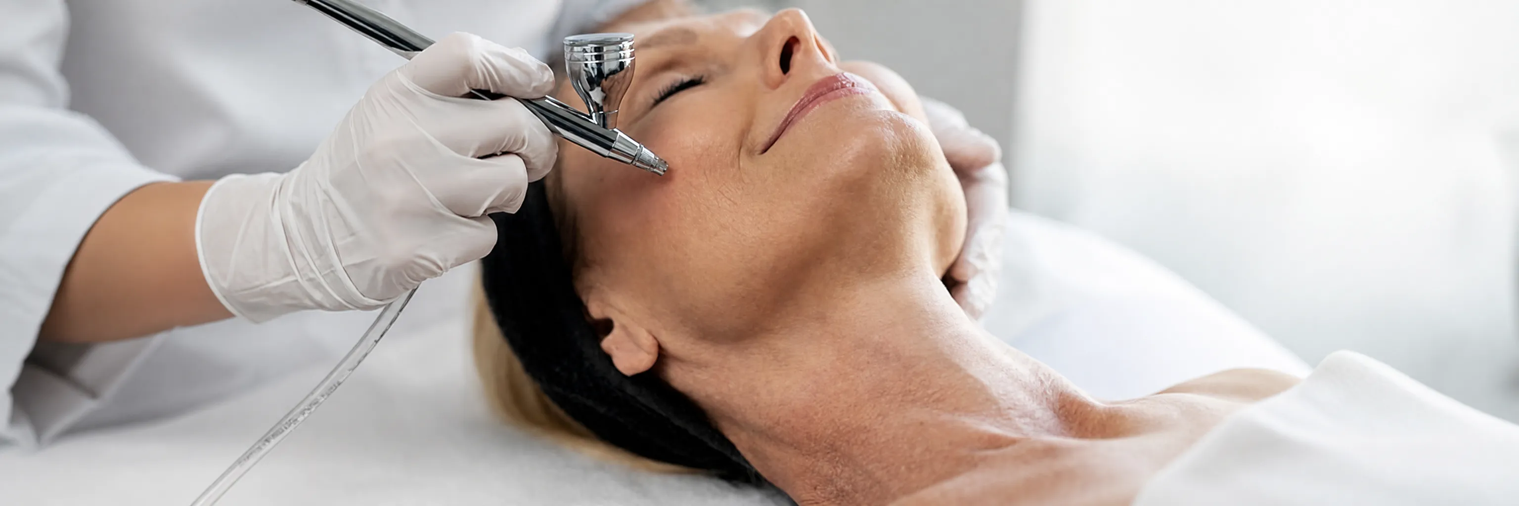 Microdermoabrasión en Glow Medical Clinique