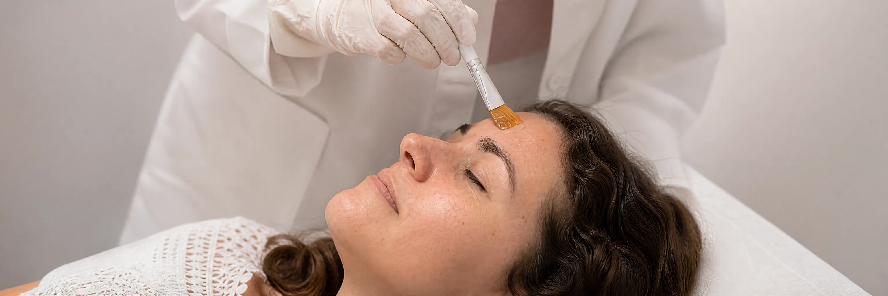 Peeling químico médico en Glow Medical Clinique