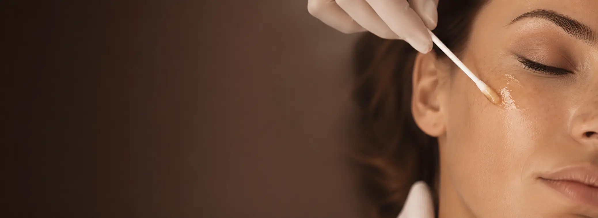 Tratamientos de Pecas y manchas en Glow Medical Clinique